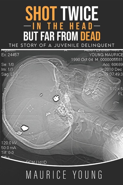 Shot Twice In The Head But Far From Dead: : The story of a juvenile delinquent (Paperback)