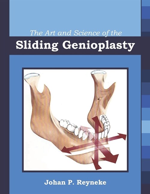 The Art and Science of the Sliding Genioplasty (Paperback)