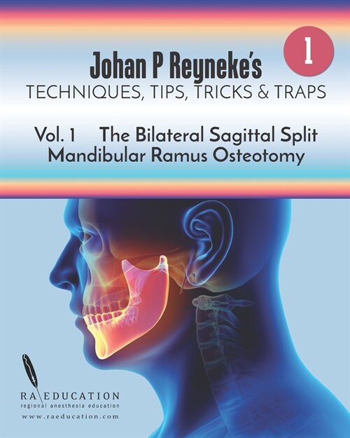 Johan P Reynekes Techniques, Tips, Tricks and Traps: Volume 1: The Bilateral Sagittal Split Mandibular Ramus Osteotomy (Paperback)