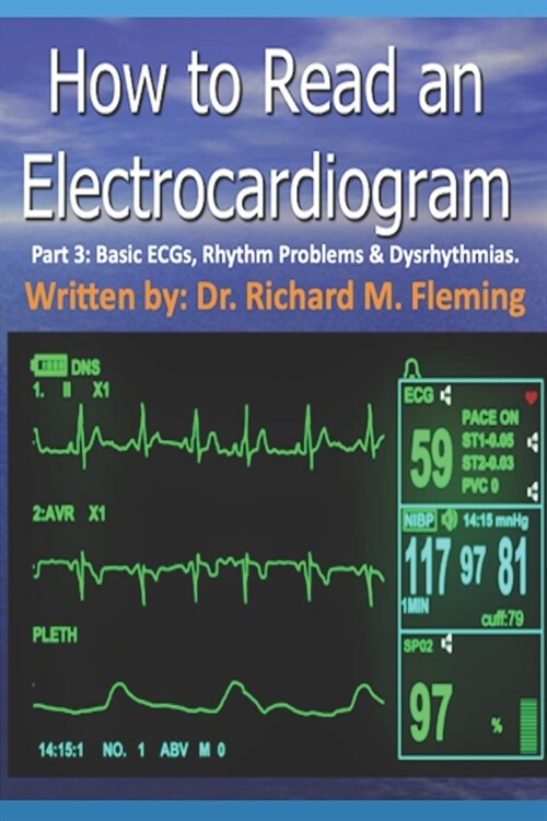 How to Read an Electrocardiogram - Part 3: Basic ECGs, Rhythm Problems & Dysrhythmias. (Paperback)