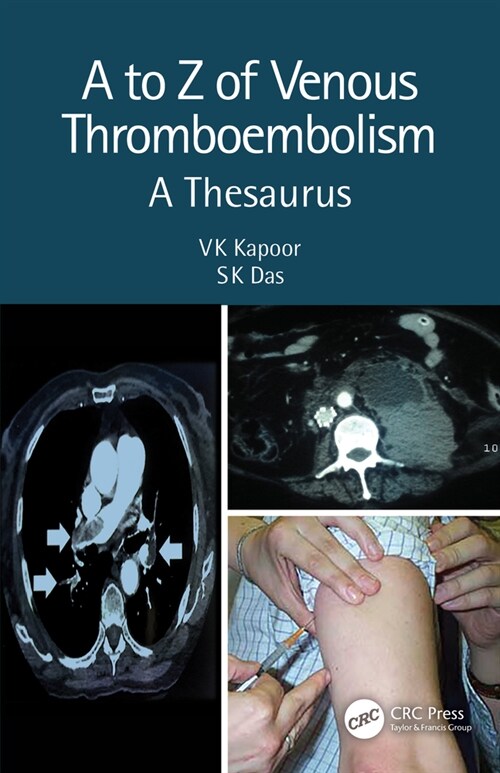 A to Z of Venous Thromboembolism : A Thesaurus (Paperback, 2 ed)