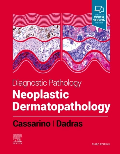 Diagnostic Pathology: Neoplastic Dermatopathology (Hardcover, 3)