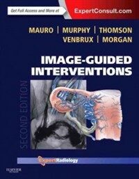 Image-guided interventions 2nd ed