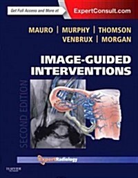 Image-Guided Interventions : Expert Radiology Series (Expert Consult - Online and Print) (Hardcover, 2 Revised edition)