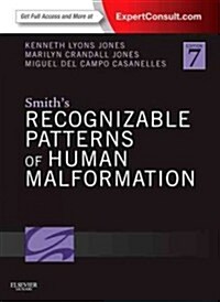 Smiths Recognizable Patterns of Human Malformation : Expert Consult - Online and Print (Hardcover, 7 Revised edition)
