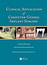 Clinical Application of Computer-Guided Implant Surgery (Hardcover, New)