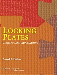 Locking Plates (Paperback, 1st)