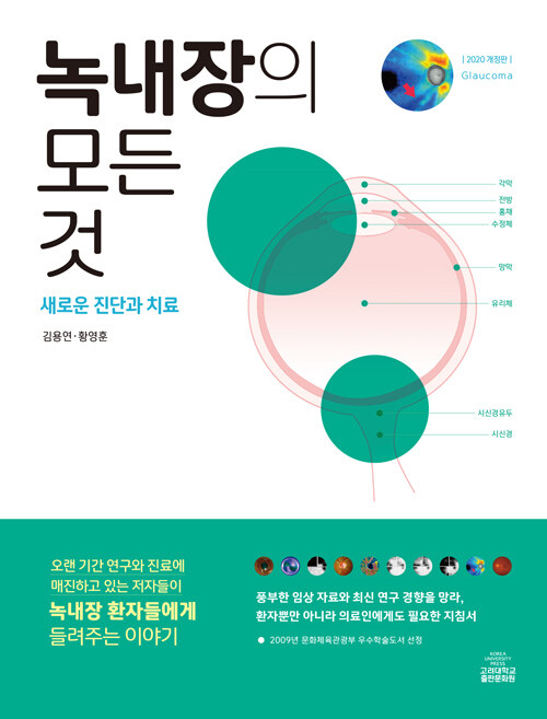 [중고] 녹내장의 모든 것