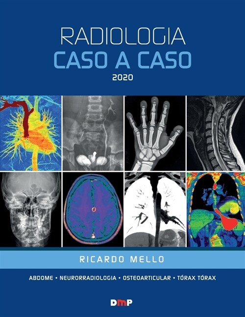 Radiologia Caso a Caso 2020 (Paperback)