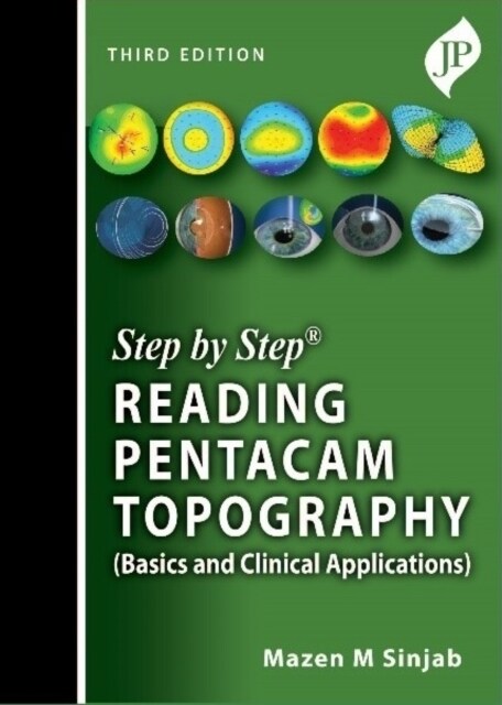 Step by Step: Reading Pentacam Topography : Basics and Clinical Applications (Paperback, 3 Revised edition)