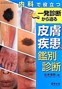 內科で役立つ 一發診斷から迫る皮膚疾患の鑑別診斷 (單行本)