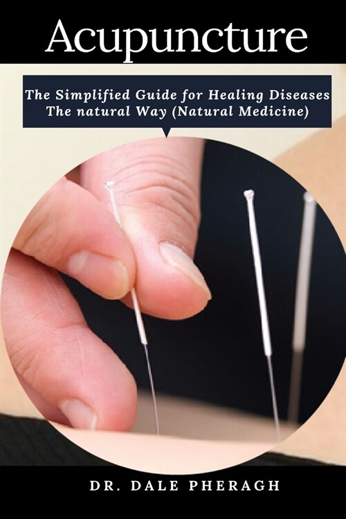 Acupuncture: The Simplified Guide for Healing Diseases The natural Way (Natural Medicine) (Paperback)