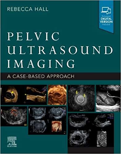 Pelvic Ultrasound Imaging: A Cased-Based Approach (Paperback)