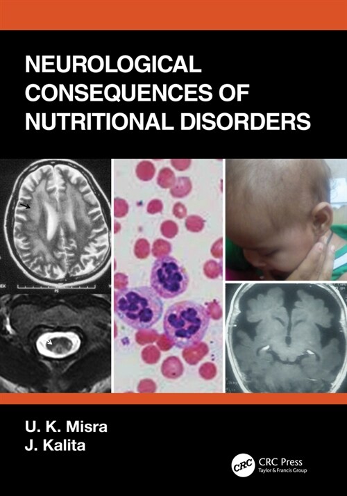 Neurological Consequences of Nutritional Disorders (Hardcover, 1)