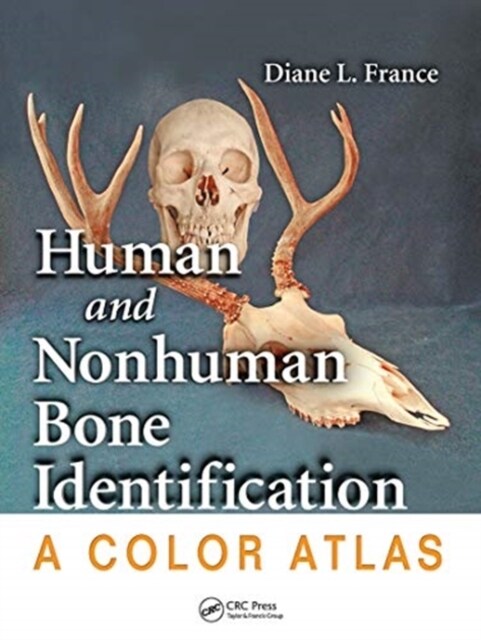 Human and Nonhuman Bone Identification : A Color Atlas (Paperback)