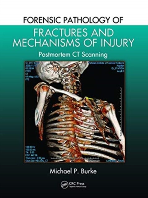 Forensic Pathology of Fractures and Mechanisms of Injury : Postmortem CT Scanning (Paperback)