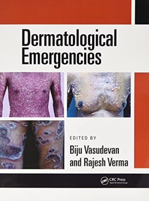 Dermatological Emergencies (Paperback, 1)