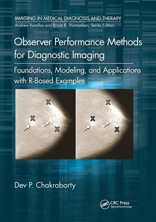 Observer Performance Methods for Diagnostic Imaging : Foundations, Modeling, and Applications with R-Based Examples (Paperback)