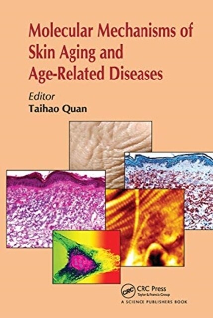 Molecular Mechanisms of Skin Aging and Age-Related Diseases (Paperback, 1)