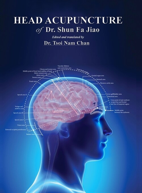 Head Acupuncture of Dr. Shun Fa Jiao (Hardcover)
