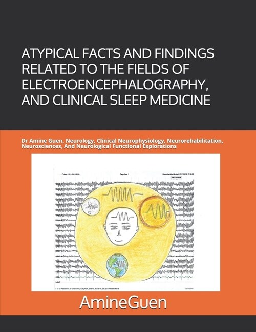 Atypical Facts and Findings Related to the Fields of Electroencephalography, and Clinical Sleep Medicine: Dr Amine Guen, Neurology, Clinical Neurophys (Paperback)