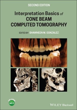 Interpretation Basics of Cone Beam Computed Tomography (Hardcover, 2 ed)