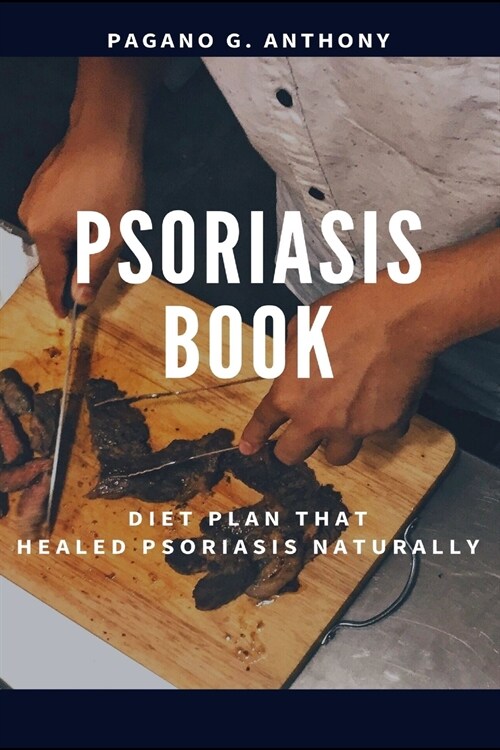 Psoriasis Book (Paperback)