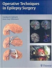 Operative Techniques in Epilepsy Surgery (Hardcover)