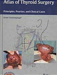 Atlas of Thyroid Surgery: Principles, Practice, and Clinical Cases [With DVD] (Hardcover)