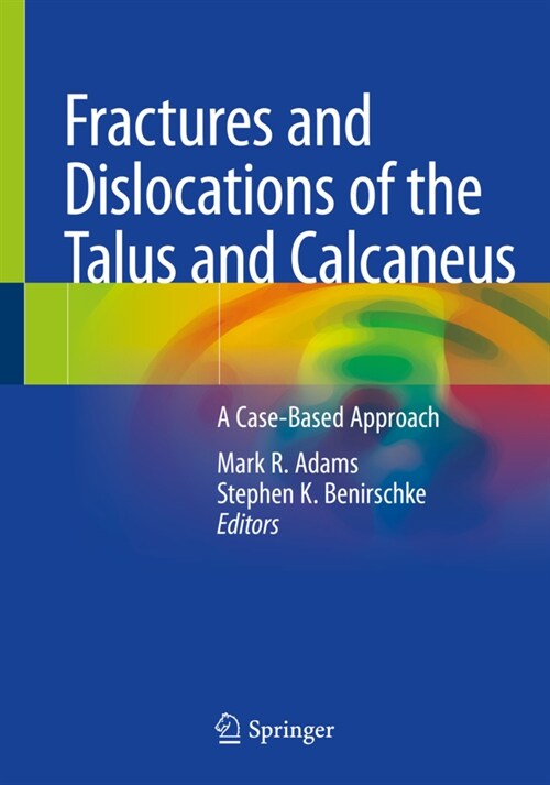 Fractures and Dislocations of the Talus and Calcaneus: A Case-Based Approach (Paperback, 2020)