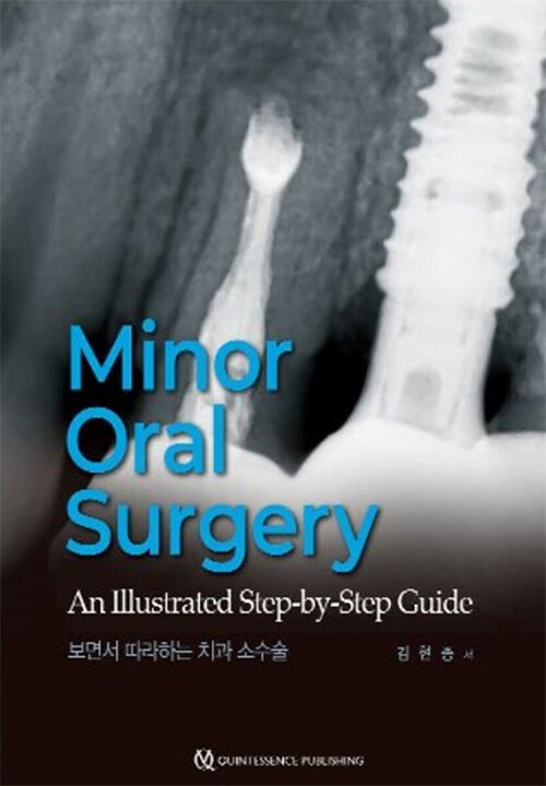 Minor Oral Surgery