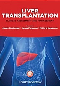 Liver Transplantation (Hardcover)