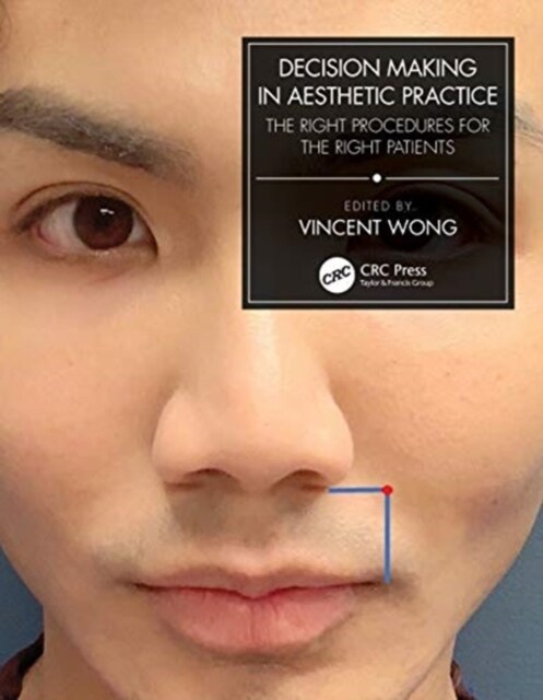 Decision Making in Aesthetic Practice : The Right Procedures for the Right Patients (Paperback)