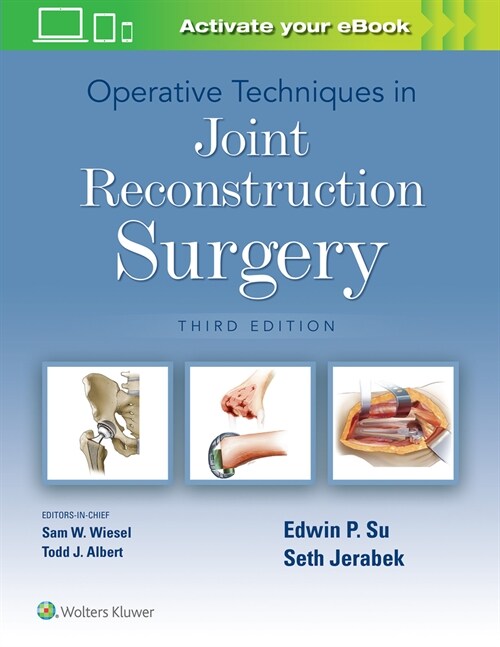 Operative Techniques in Joint Reconstruction Surgery (Hardcover, 3)