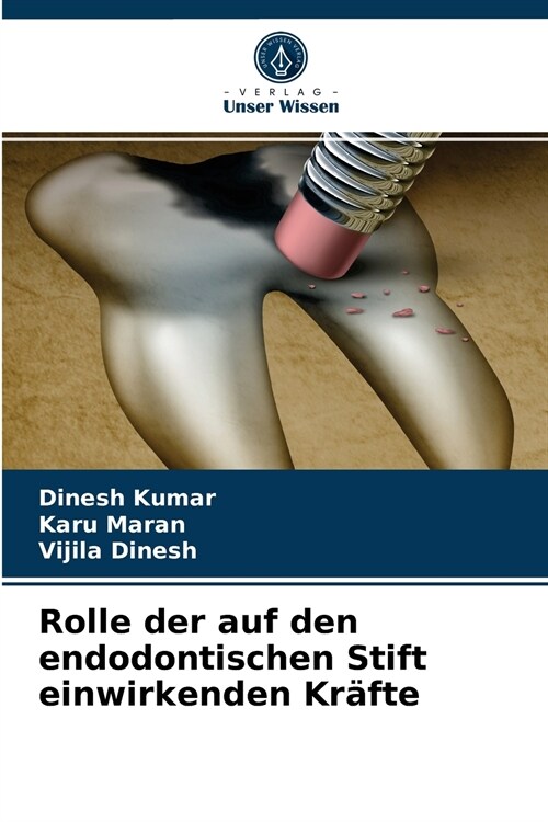 Rolle der auf den endodontischen Stift einwirkenden Kr?te (Paperback)