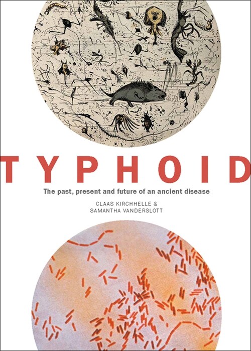 Typhoid : The past, present, and future of an ancient disease (Paperback)