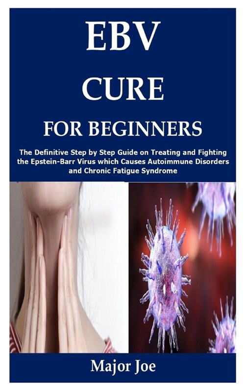 Ebv Cure for Beginners: The Definitive Step by Step Guide on Treating and Fighting the Epstein-Barr Virus which Causes Autoimmune Disorders an (Paperback)