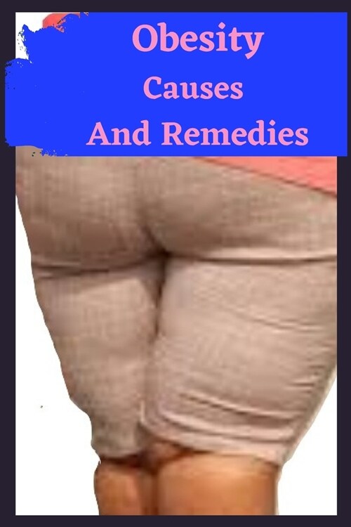 Obesity Causes And Remedies: How to lose weight, how to know about Childhood Obesity, Obesity and remedies is a practical guide on obesity that can (Paperback)