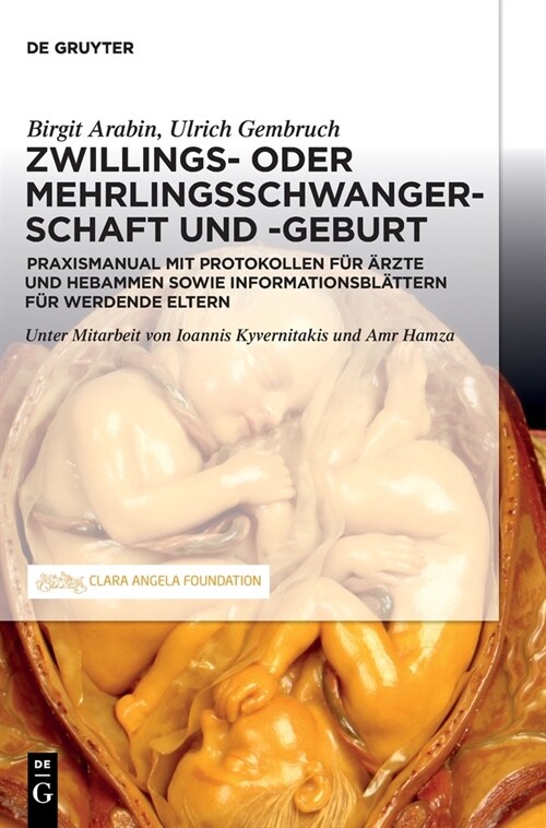 Schwangerschaft, Geburt und Wochenbett von Zwillingen und h?ergradigen Mehrlingen (Hardcover)