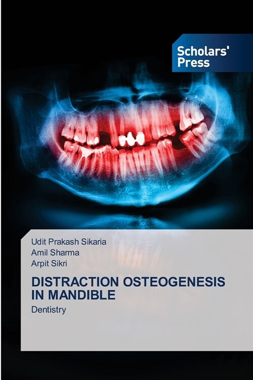 DISTRACTION OSTEOGENESIS IN MANDIBLE (Paperback)