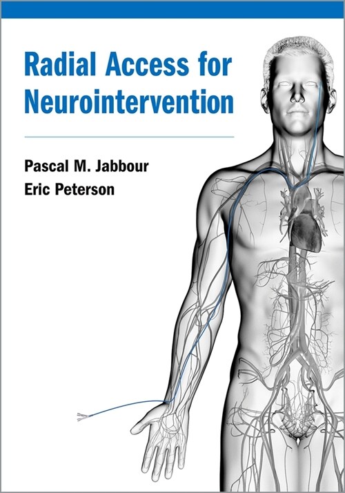 Radial Access for Neurointervention (Hardcover)