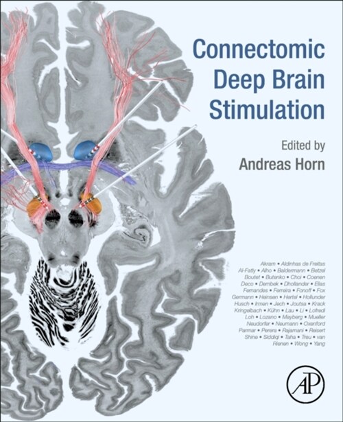 Connectomic Deep Brain Stimulation (Paperback)