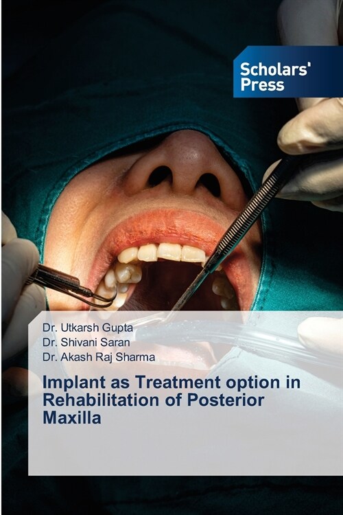 Implant as Treatment option in Rehabilitation of Posterior Maxilla (Paperback)