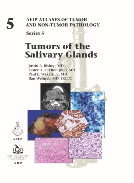 Tumors of the Salivary Glands: Series 5 (Hardcover, 5)