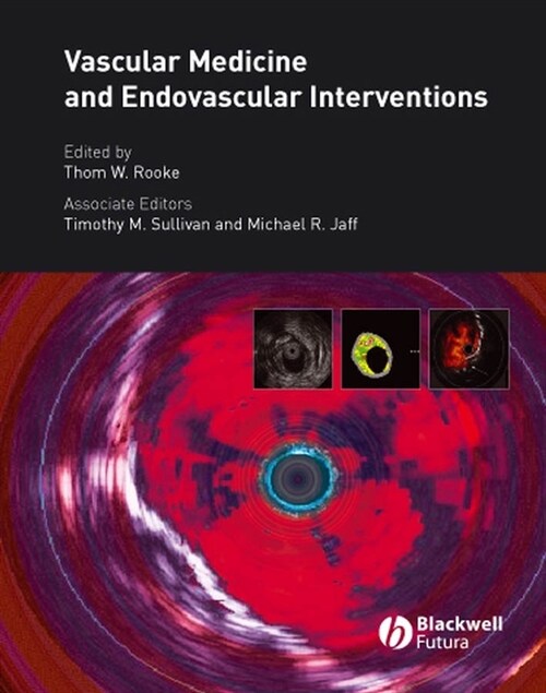 [eBook Code] Vascular Medicine and Endovascular Interventions (eBook Code, 1st)