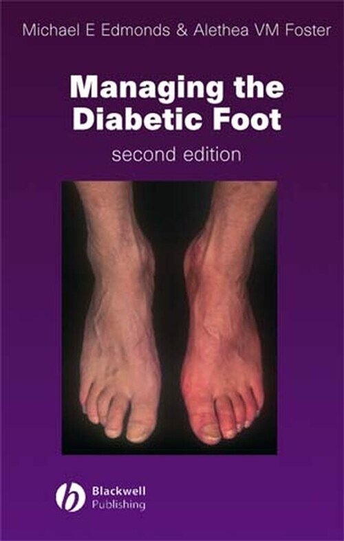 [eBook Code] Managing the Diabetic Foot (eBook Code, 2nd)