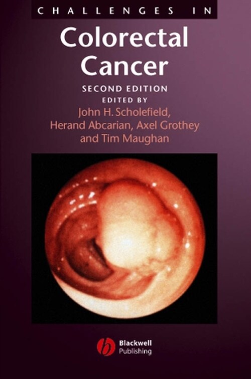 [eBook Code] Challenges in Colorectal Cancer (eBook Code, 2nd)