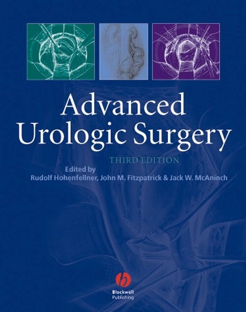[eBook Code] Advanced Urologic Surgery (eBook Code, 3rd)