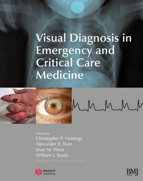 [eBook Code] Visual Diagnosis in Emergency and Critical Care Medicine (eBook Code, 1st)