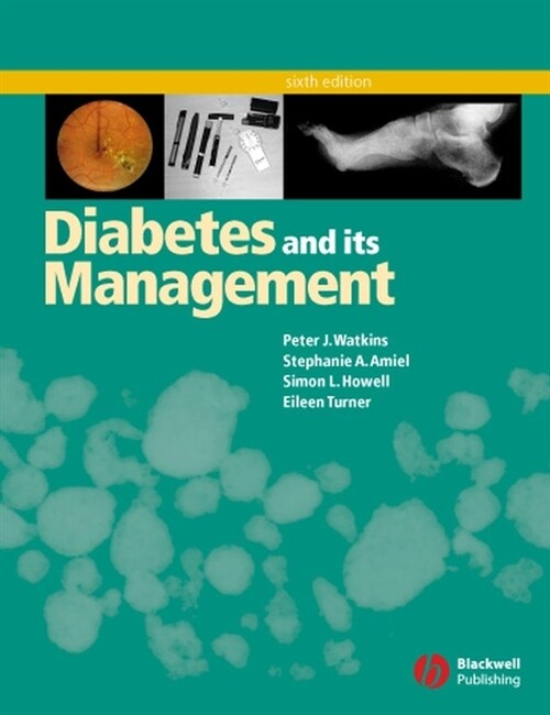 [eBook Code] Diabetes and Its Management (eBook Code, 6th)